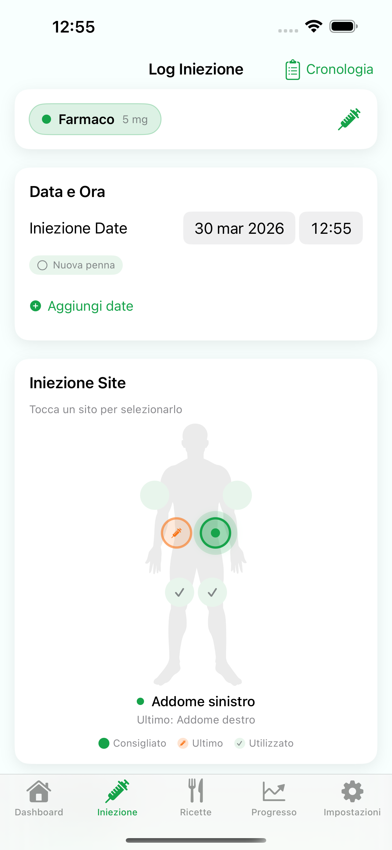 Vista del tracker iniezioni di Levida